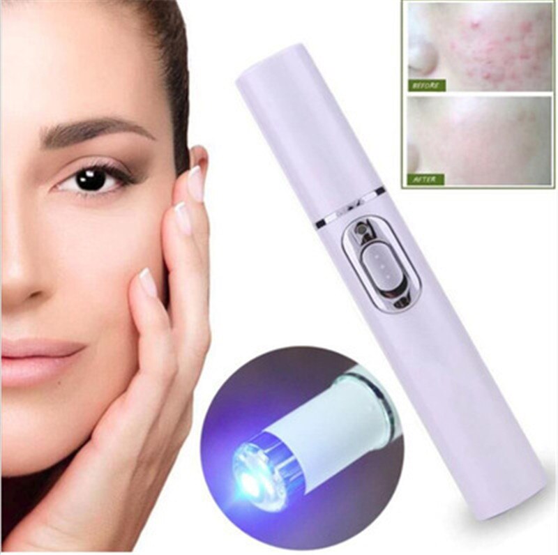 Caneta Laser para Tratamento de Acne, Estrias, Varizes e Sinais - Derma Laser